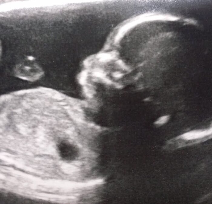 The Real Reason America Stopped Having Babies Isn't What Politicians Say