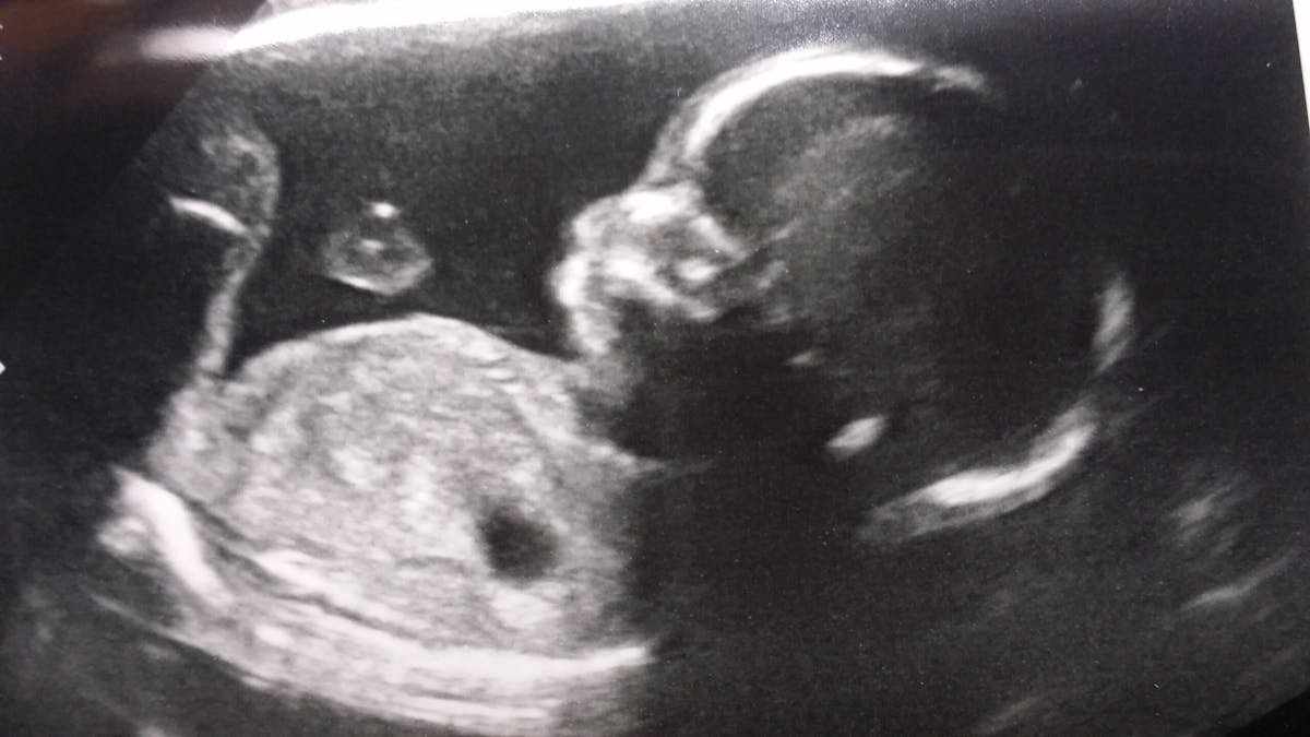 The Real Reason America Stopped Having Babies Isn't What Politicians Say