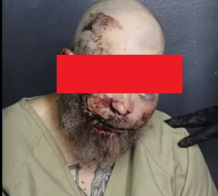 Florida Man’s Mugshot After Alleged Cop Fight Shows the Cost of 'I Want to Fight You'