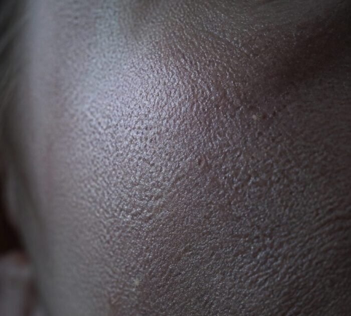 Gateway Pundit Promoted Post Claims Microscopic Face Mites Emerge at Night